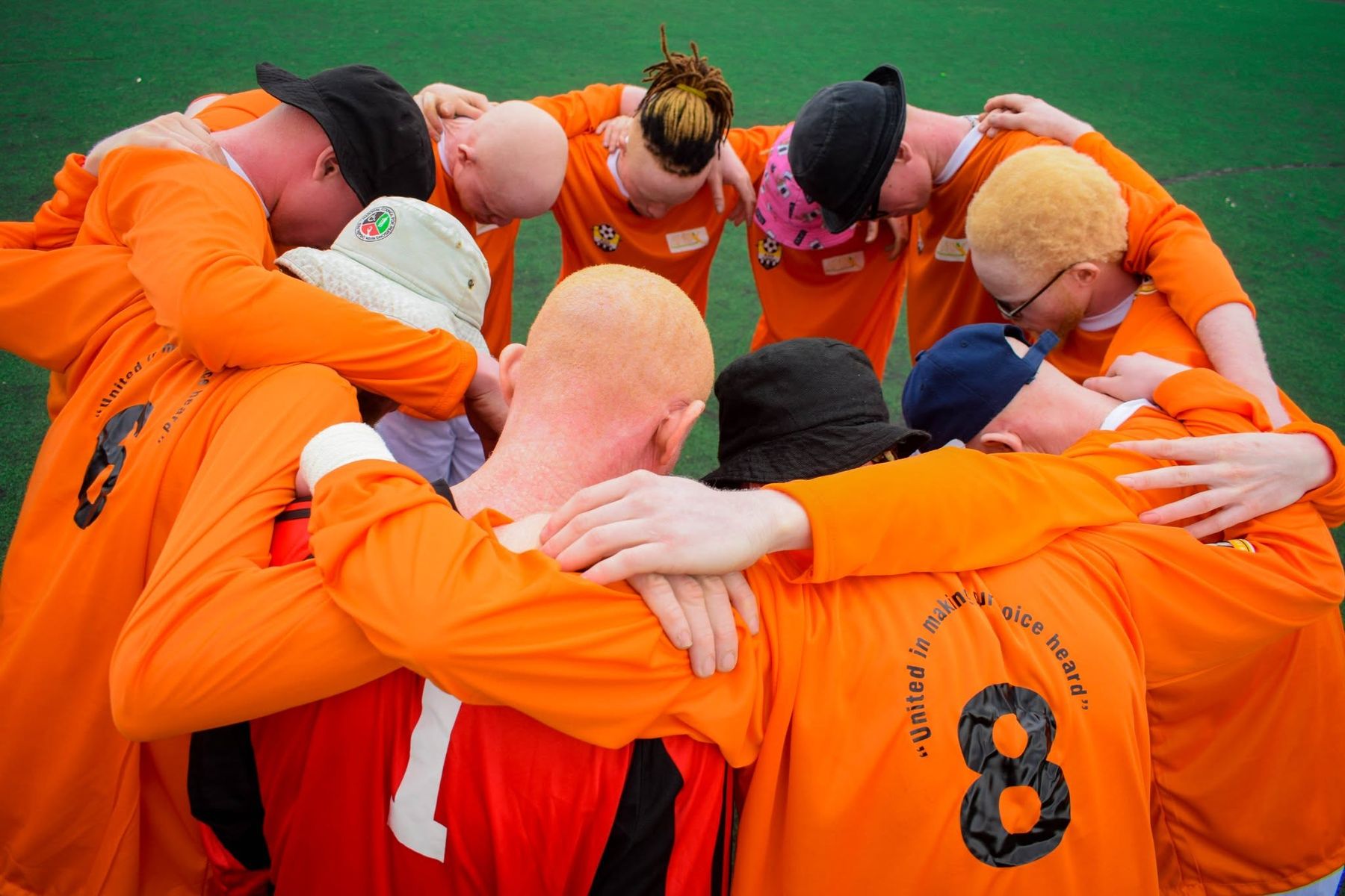 Sport run by Black Albinism, on the pitch and off it.