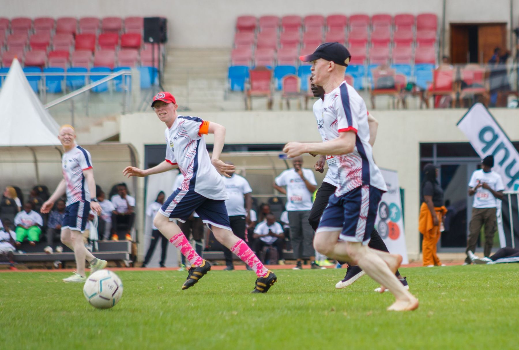 Sport run by Black Albinism, on the pitch and off it.